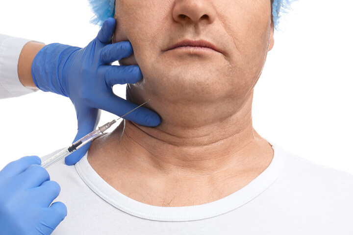 man getting a kybella injection